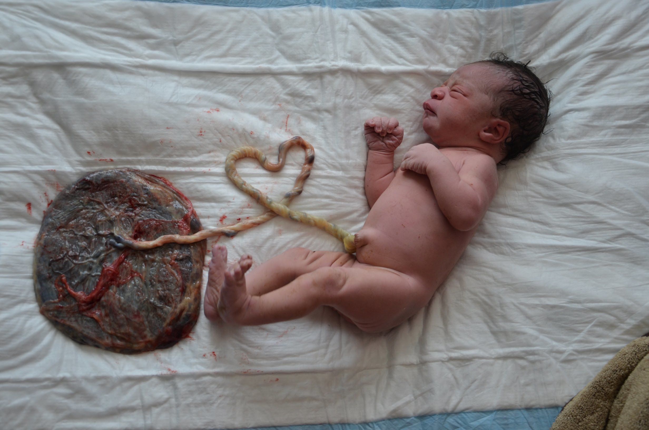 Kenali Manfaat Risiko Lotus Birth Bayi