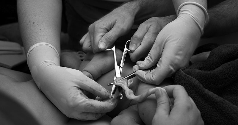 Menunda Pemotongan Tali Pusar, Selamatkan Ribuan Nyawa Bayi Prematur