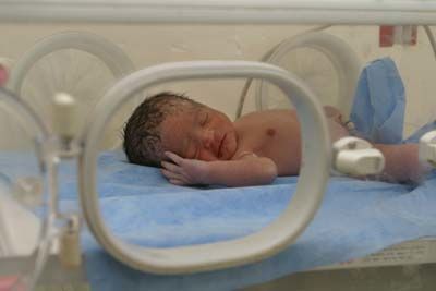 Sering Terjadi Inilah 7 Masalah Kesehatan Bayi Prematur