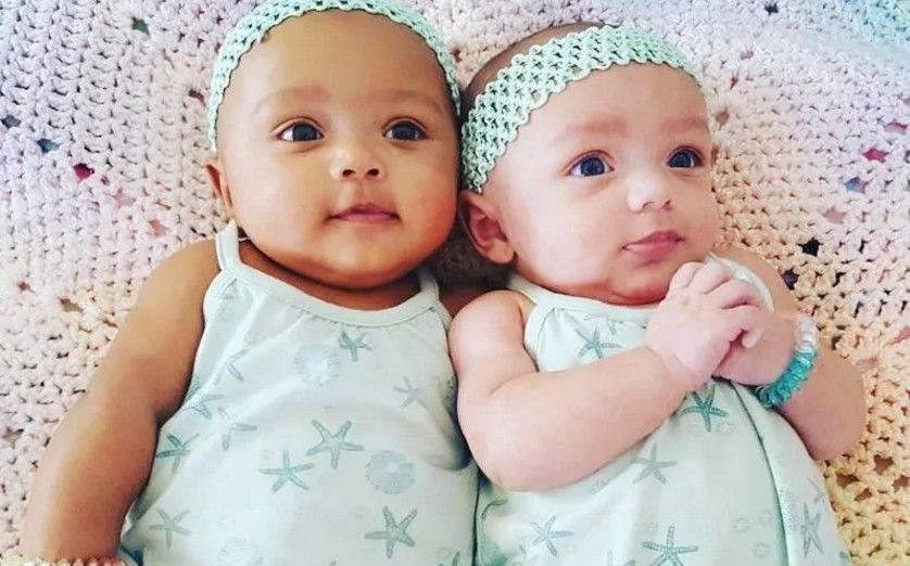 Perbedaan Proses Persalinan Bayi Kembar Persalinan Biasa