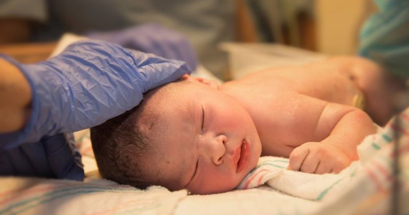 Setelah Operasi Janin Dalam Rahim, Bayi ini Bisa Selamat Hidup