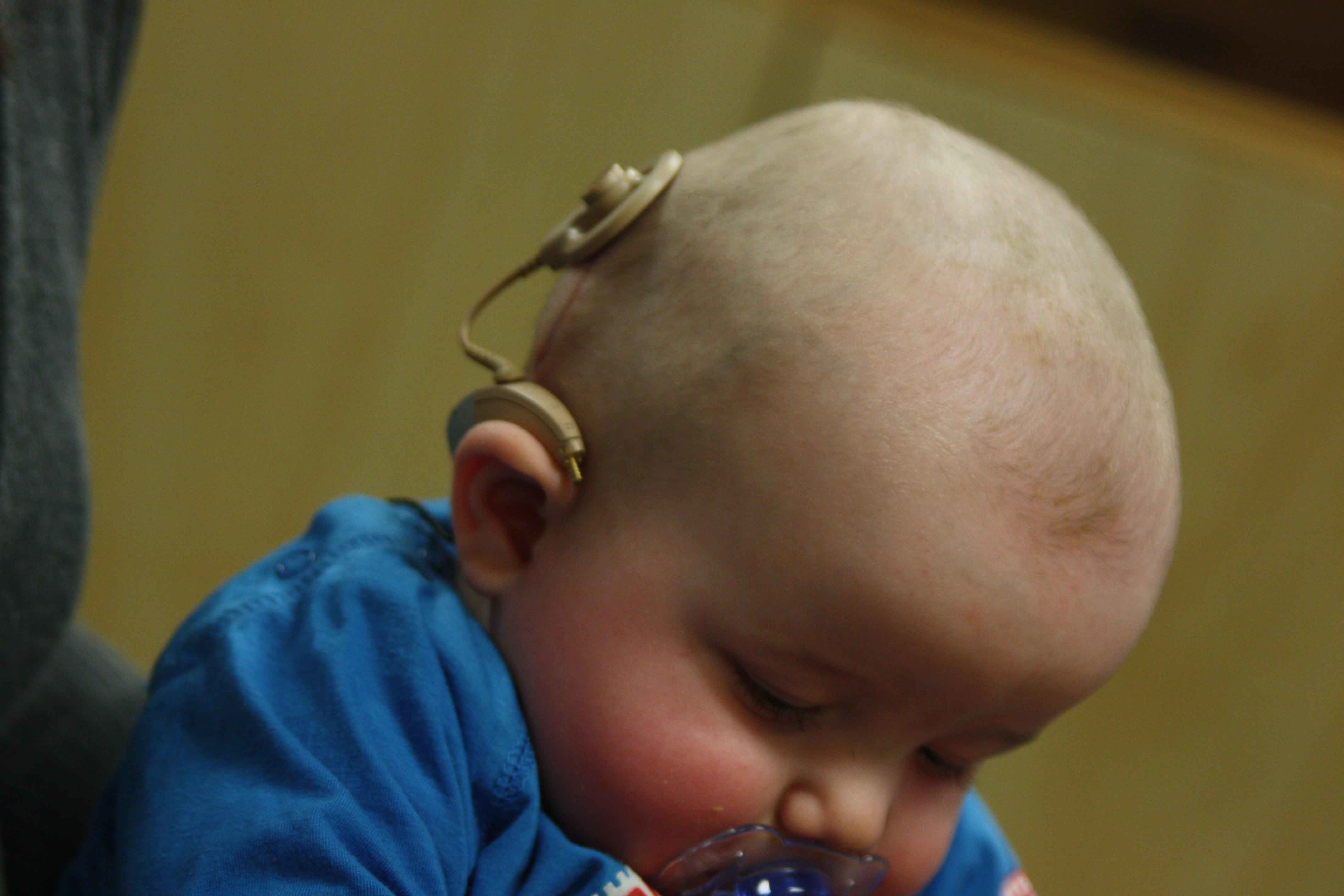 Alat Digunakan Skrining Pendengaran Bayi Baru Lahir