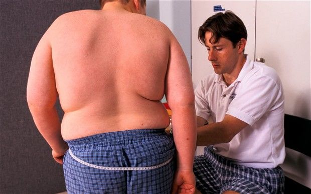 Risiko Penyakit Blount Lebih Besar Anak Obesitas