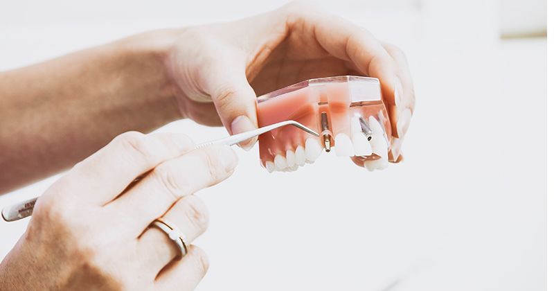 Jangan Keliru, Begini 5 Cara Perawatan Gigi Saat Hamil