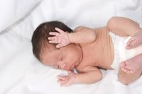 Mengapa Bayi Prematur Lebih Lambat Belajar Duduk Ketimbang Bayi Lainnya