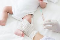 2. Vaksin BCG anak berumur 1 bulan