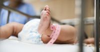 Diagnosis Mikrosefali Bayi