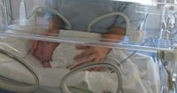 3. Meningkatkan risiko bayi lahir prematur