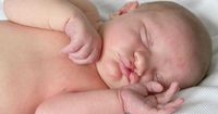 Penyebab Bayi Lahir Bibir Sumbing