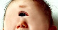 2. Faktor bayi terlahir kondisi cyclopia