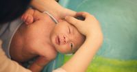 2. Cara mengatasi kulit bayi mengelupas