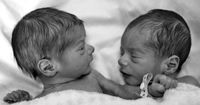 5 Cara Bijak Memperlakukan Anak Kembar