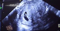 1. Pesan dokter Sarwendah kehamilan kedua