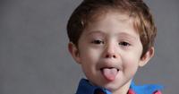 10. Pembengkakan lidah bibir