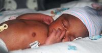 1. Manfaat ASI bagi bayi prematur