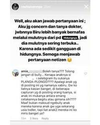 Xabiru Sering Bernapas Melalui Mulut, Begini Penjelasan Medisnya