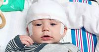 Epilepsi Langka Membuat Bayi ini Menangis 15 Jam Tanpa Henti