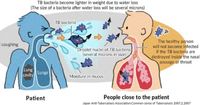Penyebab Tuberkulosis Anak