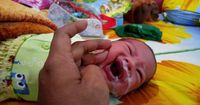 Bayi Gumoh Lewat Hidung, Kenali Penyebab Cara Mengatasinya
