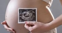 3. Penyebab plasenta lengket