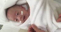 Wow Bayi Paling Kecil Sedunia Lahir 268 Gram, Selamat Sehat