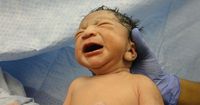 3. Apa saja penyebab bayi terlahir prematur 