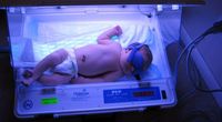 7. Bagaimana penanganan fototerapi bayi kuning