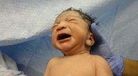 Pertama Dunia, Bayi Laki-Laki Irak Lahir 3 Penis