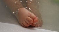 Kaki Bayi Bengkok Gejala, Penyebab, Cara Mengatasinya