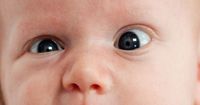 1. Apa penyebab mata juling bayi