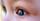 6. Penyebab Retinoblastoma