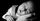 Mengenal Craniosynostosis, Bentuk Kepala Bayi Tidak Sempurna