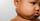Kelenjar Getah Bening Anak 3 Tahun Penyebab, Gejala, Pengobatan