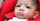 4. Anak menderita cerebral palsy