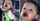 Mengejutkan, Bayi 12 Bulan Alami Bengkak Bibir Akibat Kaki Seribu