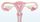 Apa itu Polip Endometrium