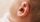 4. Ada infeksi terjadi telinga bayi