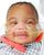3. Lahir 21 minggu usia kandungan, Curtis menjadi bayi paling prematur lahir ke dunia