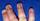 7. Onychomycosis