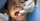 5. Splinting gigi
