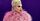 3. Lady Gaga lupus karena keturunan
