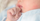 Penyebab Cara Mengatasi Biang Keringat Bayi