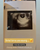 4. Memperlihatkan foto USG bayi dikandungnya