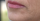 6. Vertical lip lines