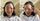 5 Fakta Perempuan Idap Vitiligo usai Lakukan Bleaching Rambut