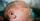 5 Penyebab Bentol Merah seperti Gigitan Nyamuk Kulit Bayi