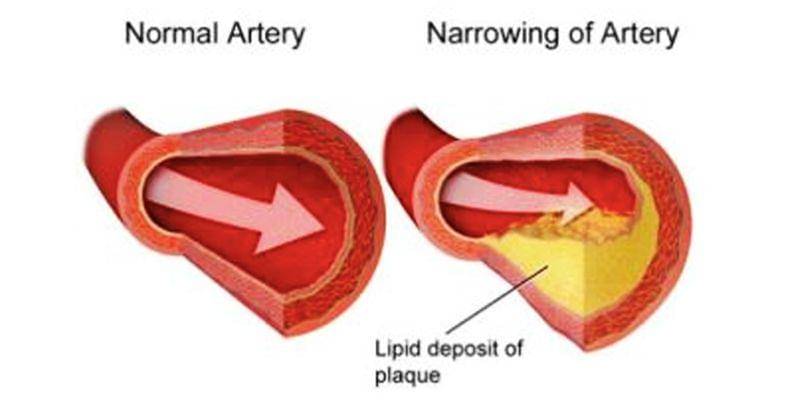 Dok. Popmama.com/RS. Evasari Awal Bros