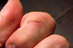 Flickr/Steven Dopolo