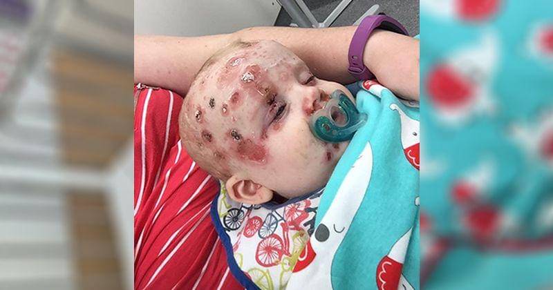 Facebook.com/Kayley Burke