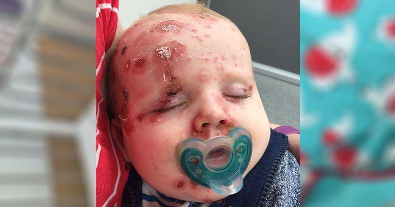 Facebook.com/Kayley Burke